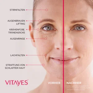 Vitayes Instant Ageback Lifting Cream
